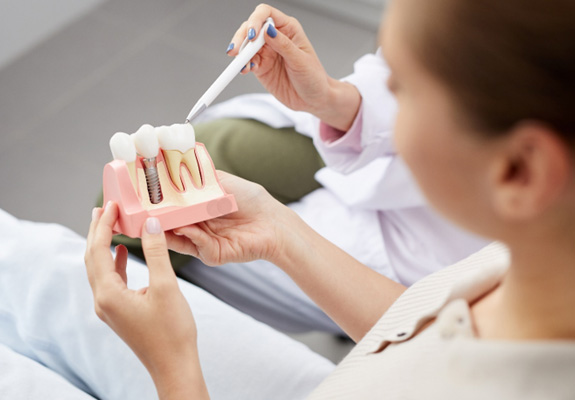 Dentist pointing to sample implant with white pen