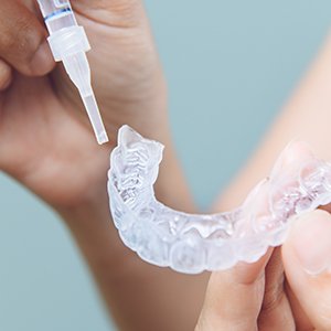 Custom teeth whitening trays and professional-grade gel kit on a white surface 